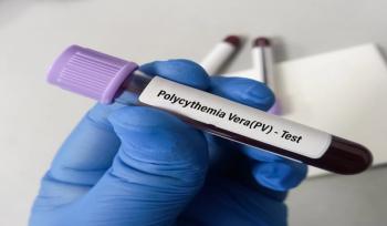 Polycythemia vera | Image Credit: © MdBabul-stock.adobe.com