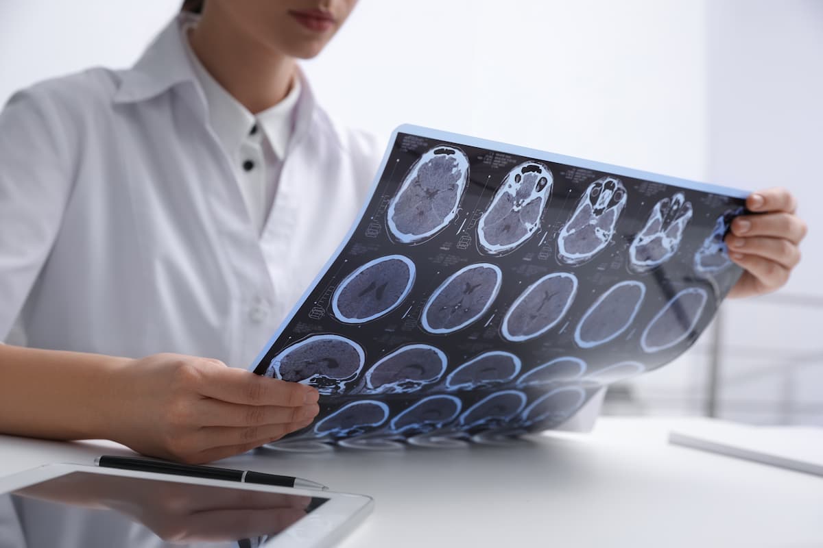 Doctor examining MRI images - New Africa - stock.adobe.com