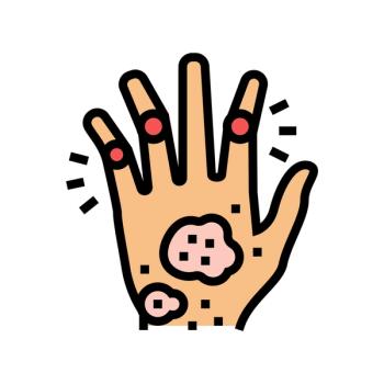 psoriatic arthritis hand illustration | vectorwin - stock.adobe.com