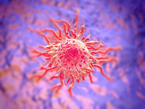 Sofosbuvir-Based Therapy Safe in Patients With HCV and Certain Cancers 