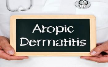 Atopic dermatitis | Image Credit: © DOC RABE Media-stock.adobe.com