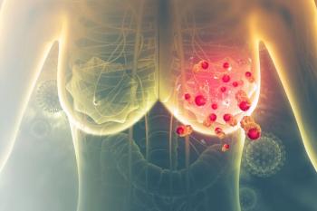 Breast cancer - Crystal light - stock.adobe.com