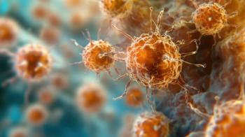 Microscopic view of non small cell lung cancer cells. Image Credit: © Keopaserth - stock.adobe.com