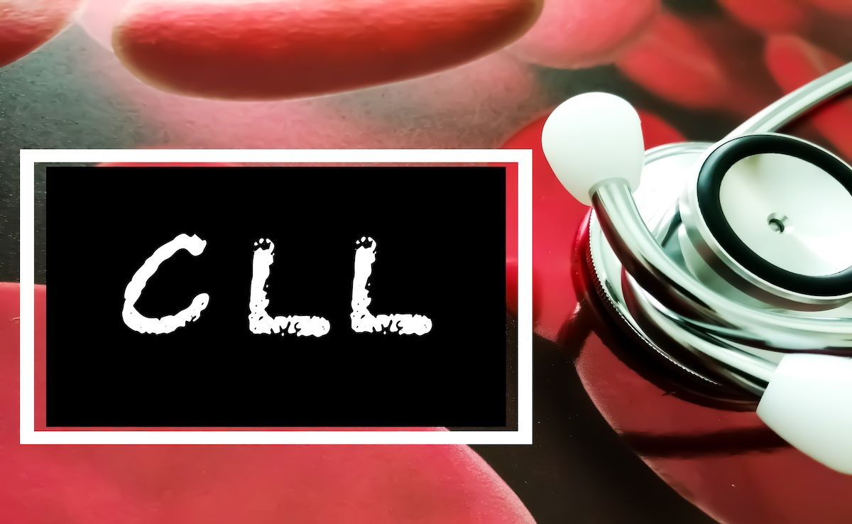 CLL | Image credit: Saiful52 – stock.adobe.com