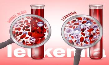 Leukemia | Image Credit: © Double Brain-stock.adobe.com