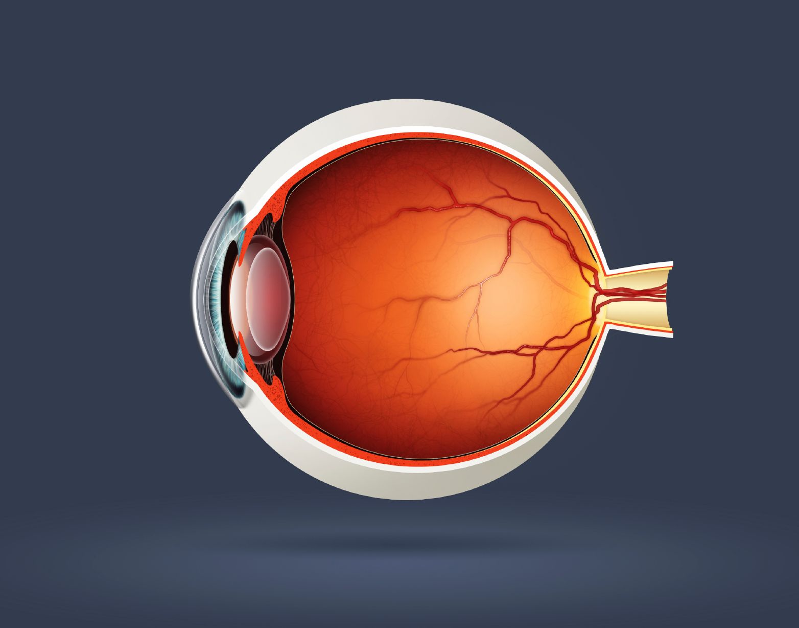 Retinal Age Associated With Incidence of Parkinson Disease, According to Study