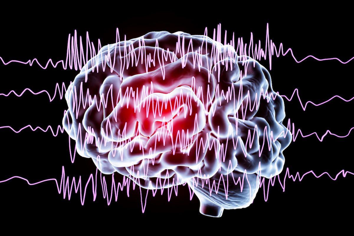 Murine Study Uncovers Novel Way CBD Reduces Seizures