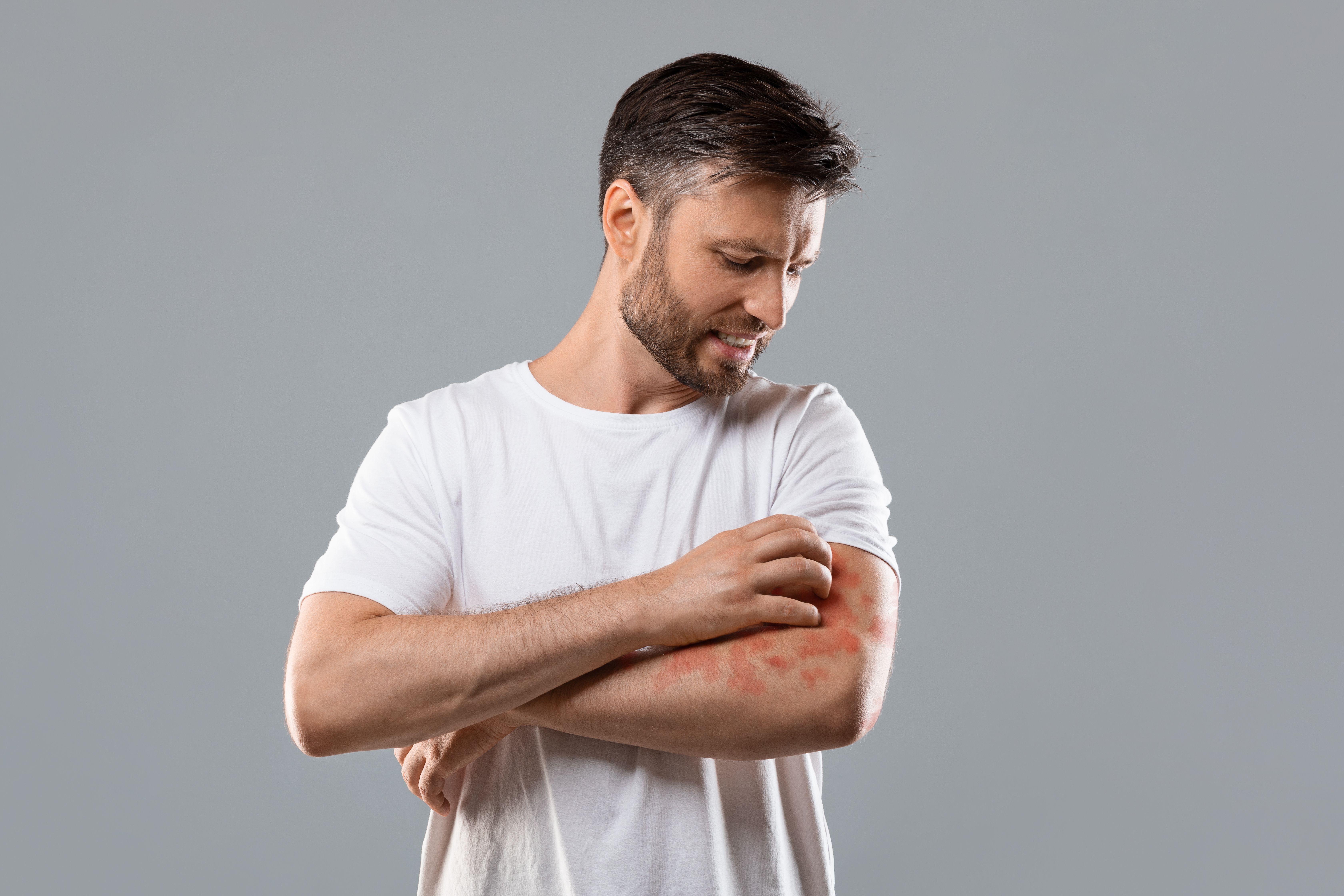 man scratching his atopic dermatitis