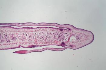 Image of a tapeworm