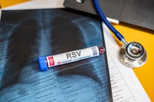 The investigators found that 28.0% of adults had at least one diagnosed risk factor for severe RSV. | Image credit: JUN LI - stock.adobe.com