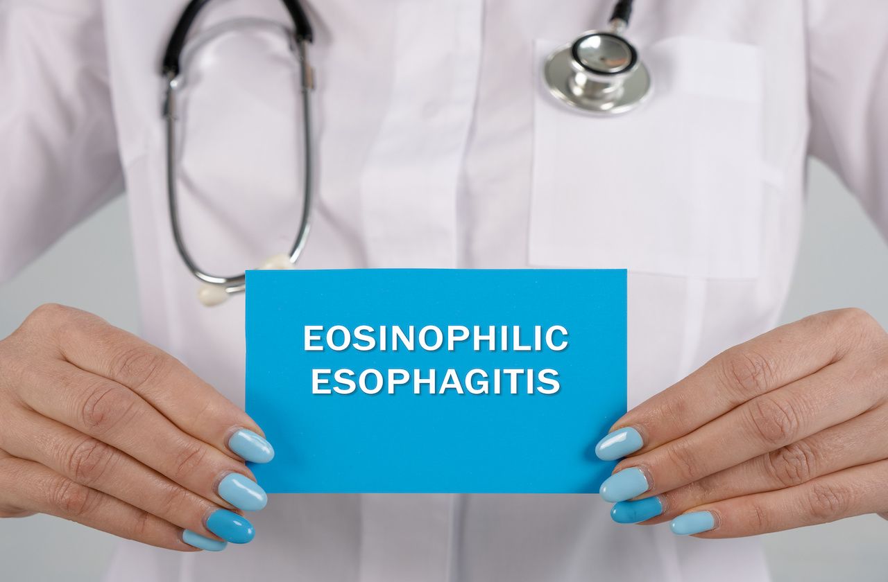 EOSINOPHILIC ESOPHAGITIS inscription on the sheet: © Yurii Kibalnik - stock.adobe.com