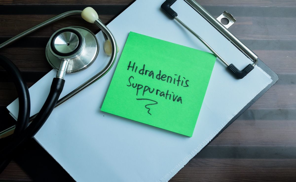 New genetic evidence suggests increased BMI and inflammatory bowel disease causally raise the risk of hidradenitis suppurativa. | Image credit: @syahrir-AdobeStock.jpeg