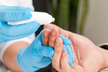 Doctor treats nails psoriasis | fusssergei - stock.adobe.com