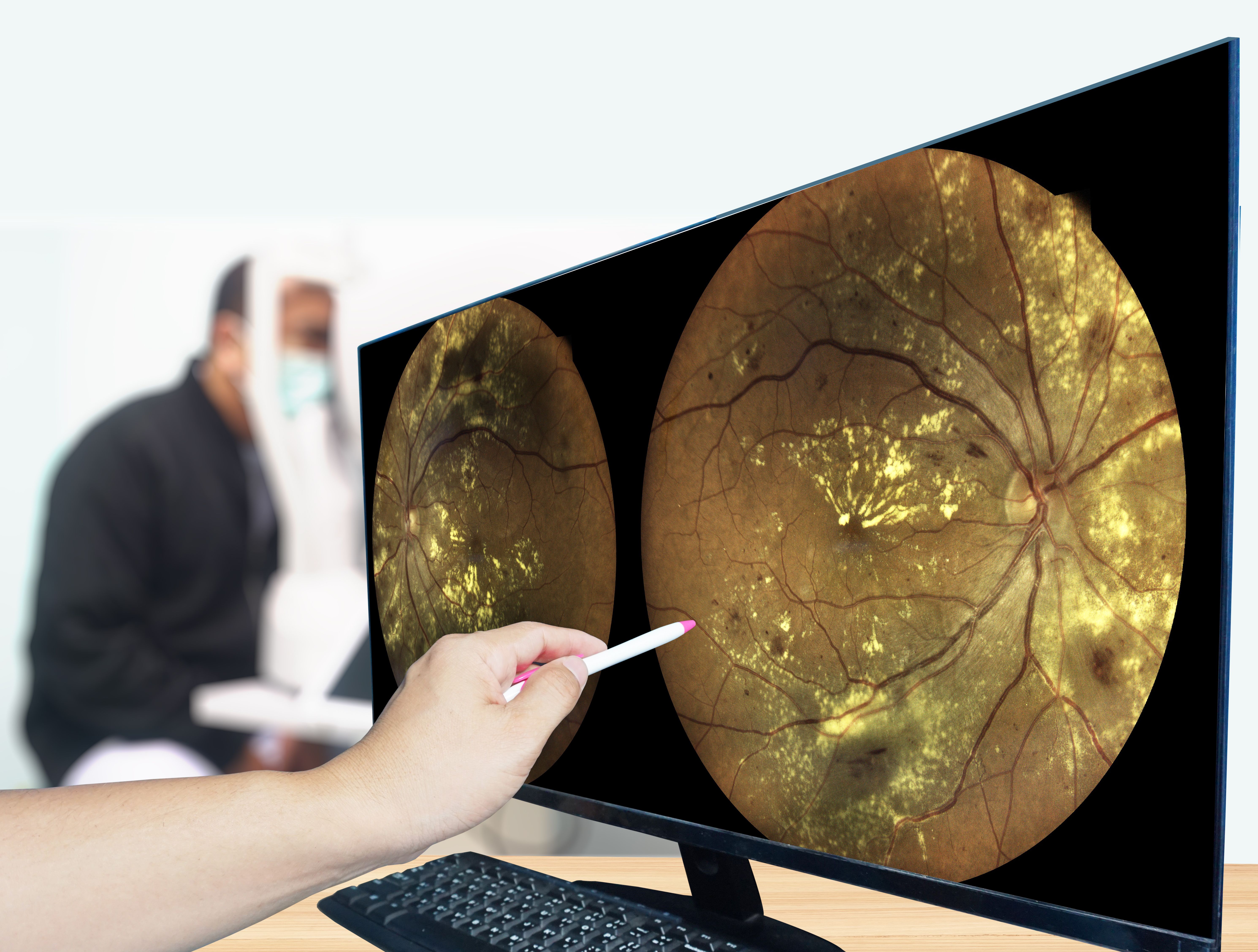 Fundus photography examination | Image credit: Richman Photo - stock.adobe.com