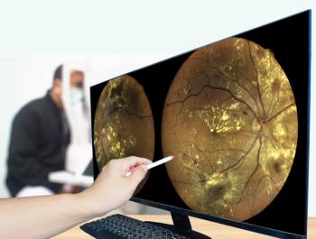 Fundus photography examination | Image credit: Richman Photo - stock.adobe.com