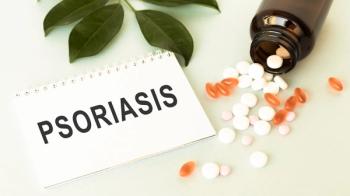 Psoriasis oral treatment | Image credit: Pawel - stock.adobe.com