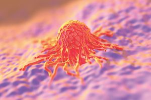 NCCN Releases New Guidelines for Rare Cancers During Pregnancy