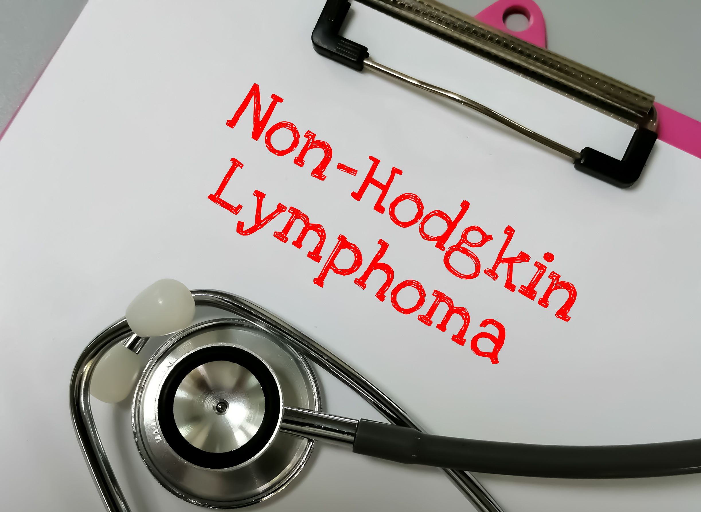 Non-Hodgkin Lymphoma | Image credit: Saiful52 - stock.adobe.com