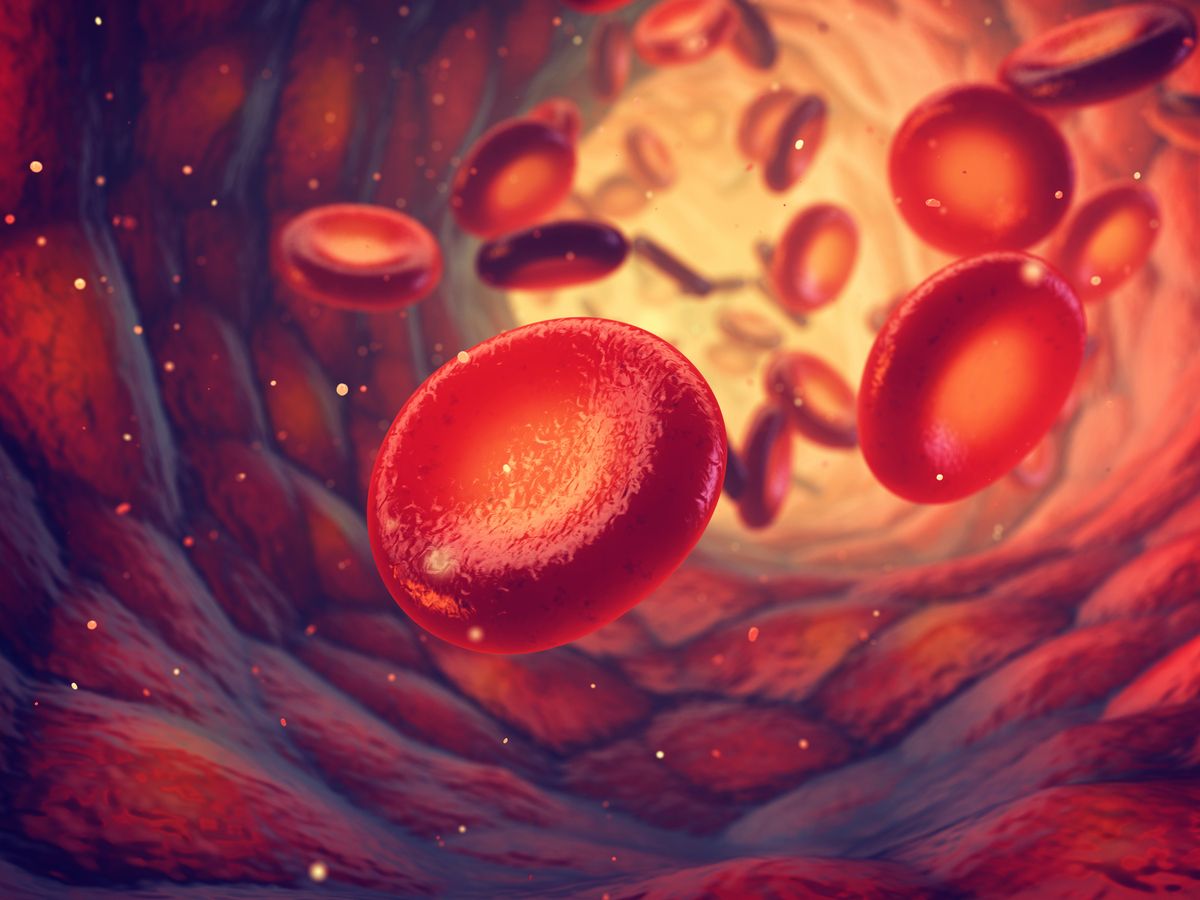 Analysis of Beti-Cel for Severe β-Thalassemia Shows Extensive, Long-term Patient Improvement