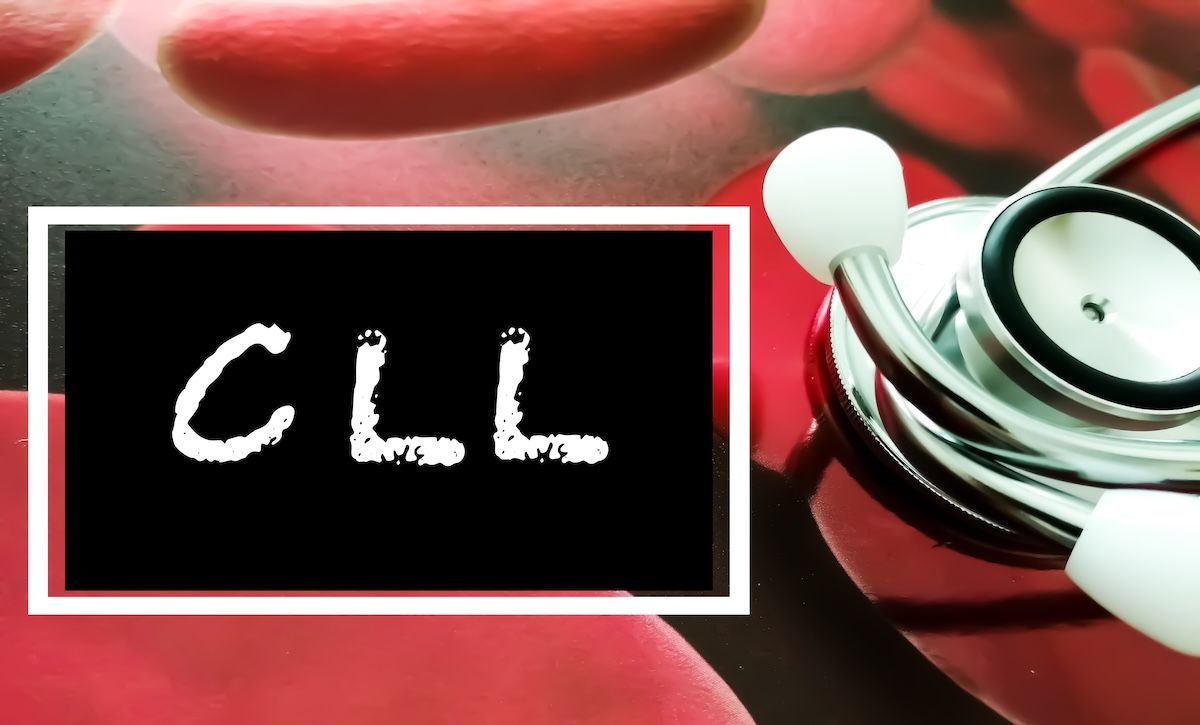 CLL | Image Credit: © Saiful52-stock.adobe.com