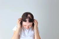 Top of woman's scalp showing hair loss | Image credit: Nadya Kolobova - stock.adobe.com
