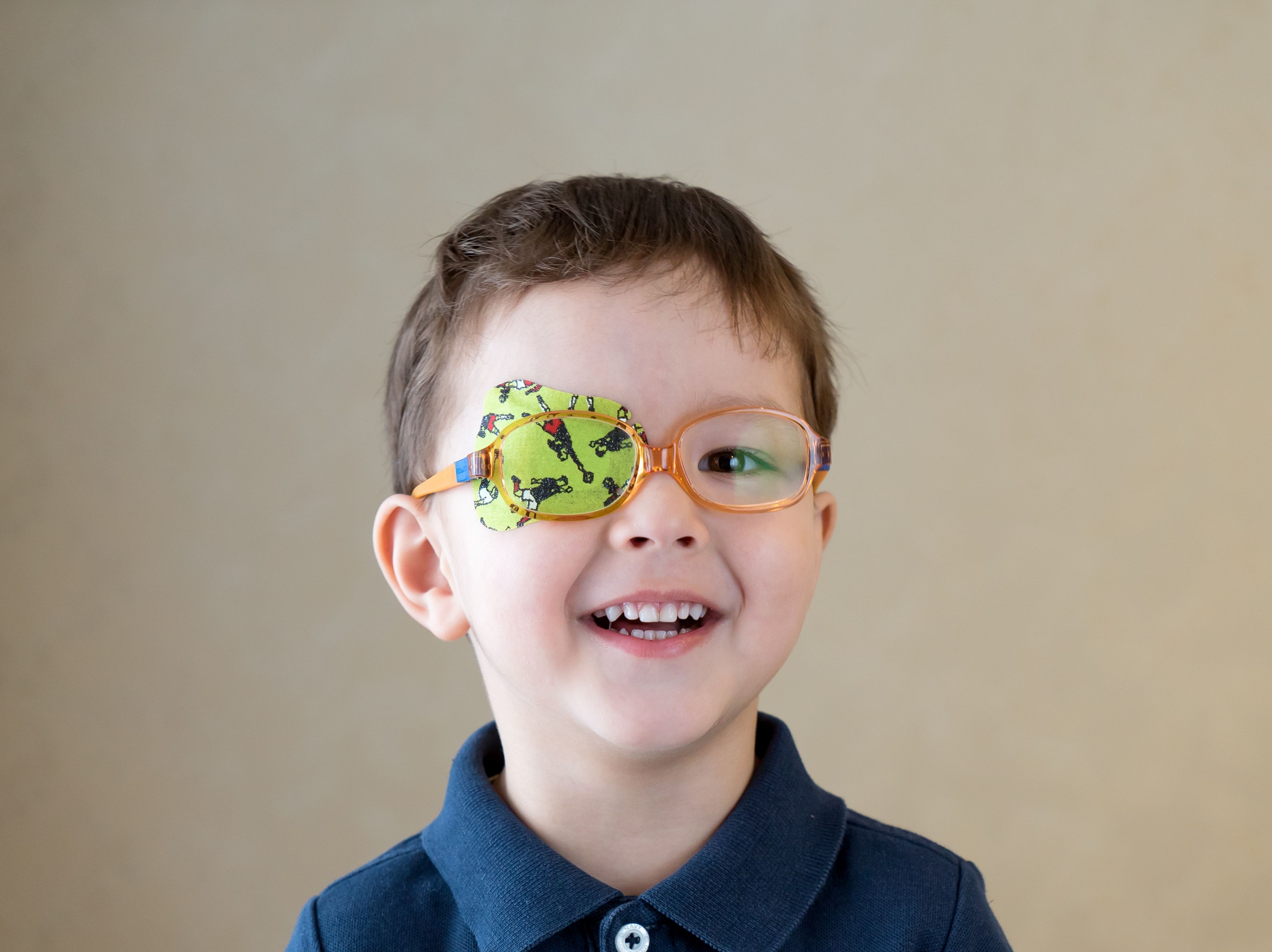 Amblyopia | Image credit: sasha1806 - stock.adobe.com