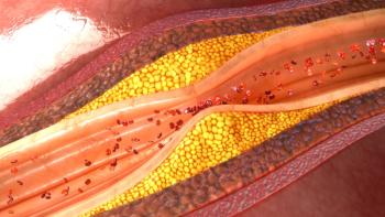 Artery with plaque