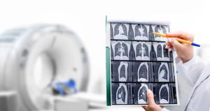 Radiologist showing tomography scan of a patient's lungs over of CT machine. Treatment of lung diseases, pneumonia, coronavirus, covid, cancer, tuberculosis | Image credit: © Peakstock - stock.adobe.com.