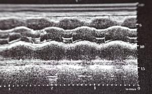 Echocardiography | Image Credit: Tamer-stock.adobe.com