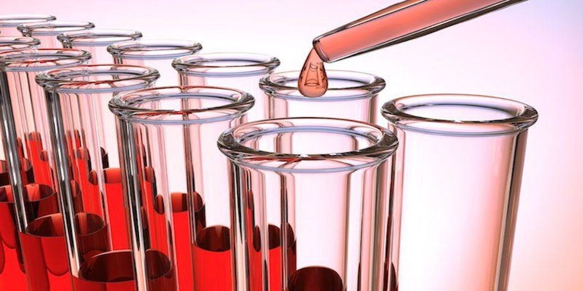 Image of blood samples in test tubes