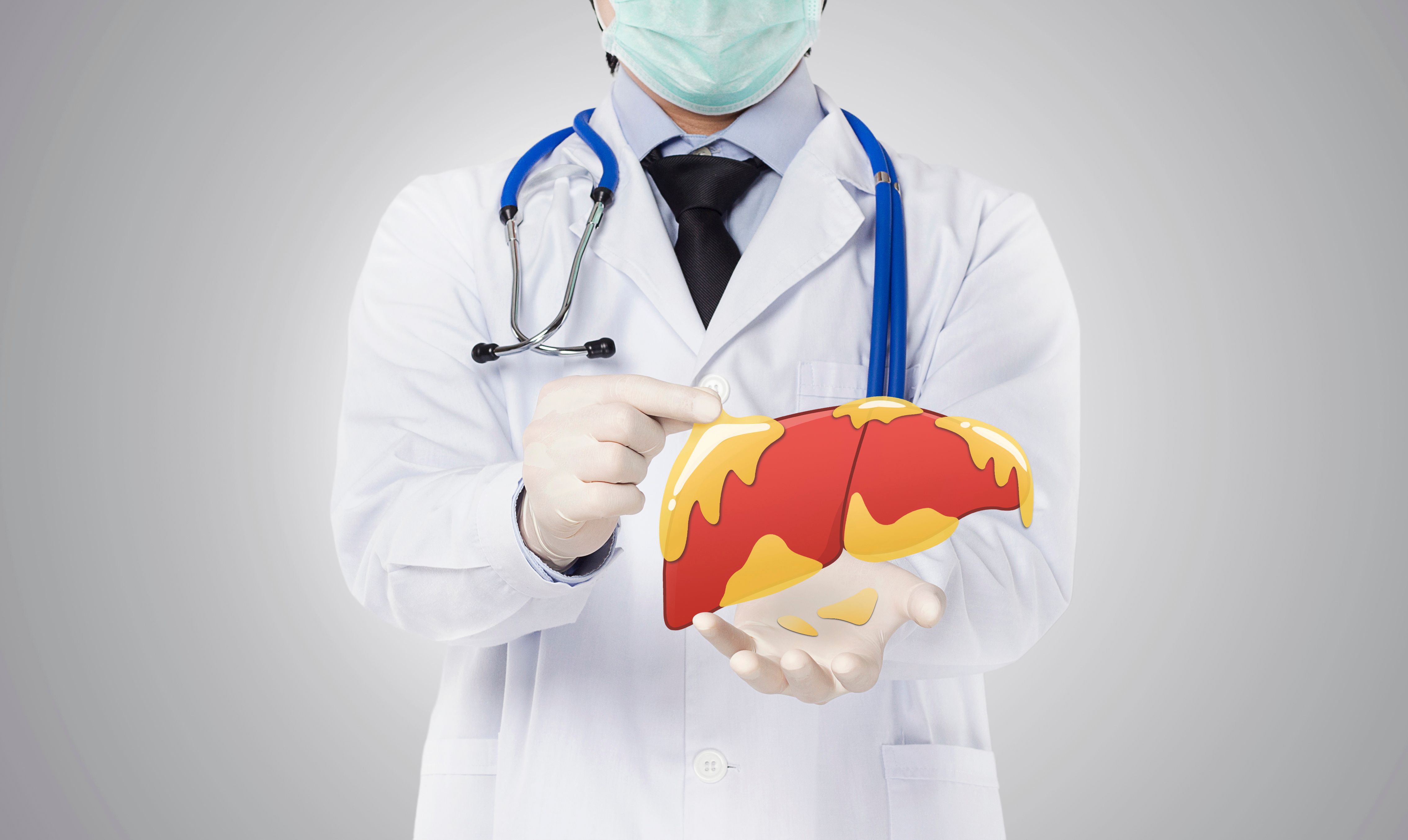 Doctor holding up image of fatty liver | Image credit: SoftSheep – stock.adobe.com