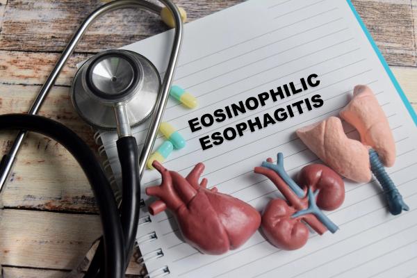Eosinophilic esophagitis | Image Credit: syahrir - stock.adobe.com