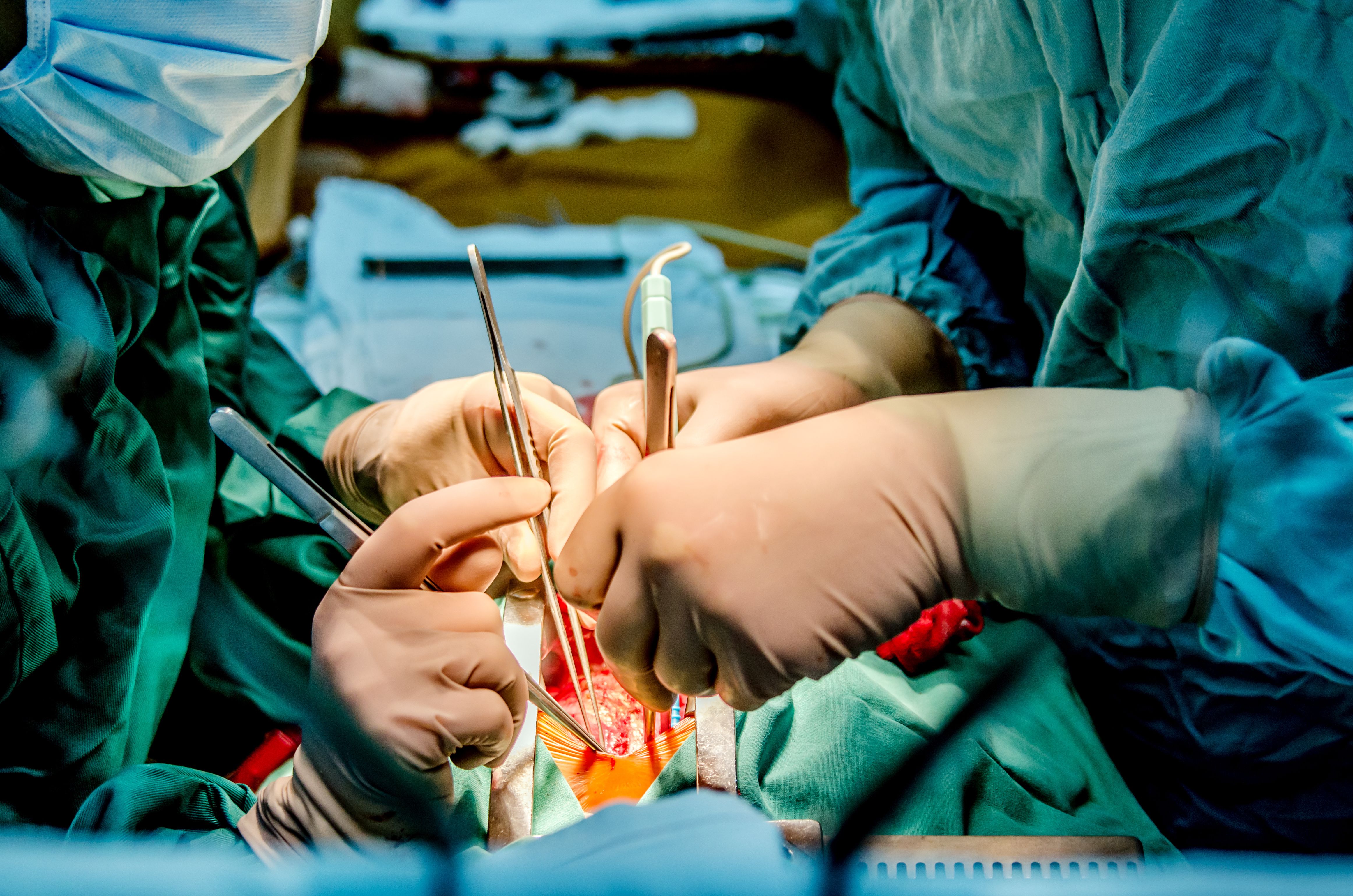 Heart Surgery | Image credit: daria_serdtseva - stock.adobe.com