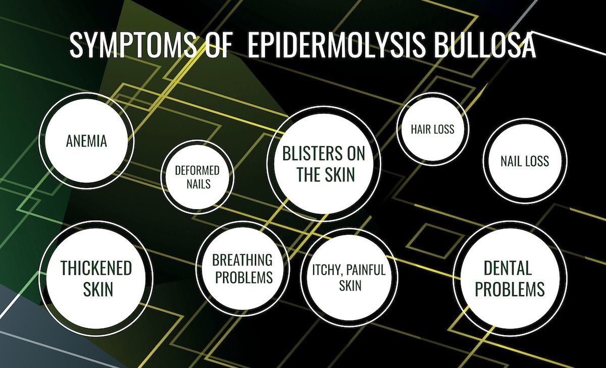symptoms of epidermolysis bullosa  | Image Credit: ангелина ковальчук-stock.adobe.com