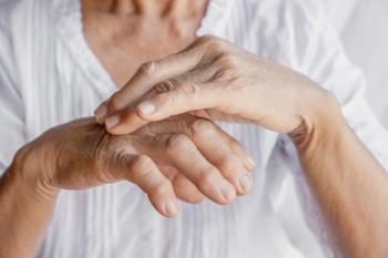 Hand pain gout arthritis | Image credit: doucefleur - stock.adobe.com