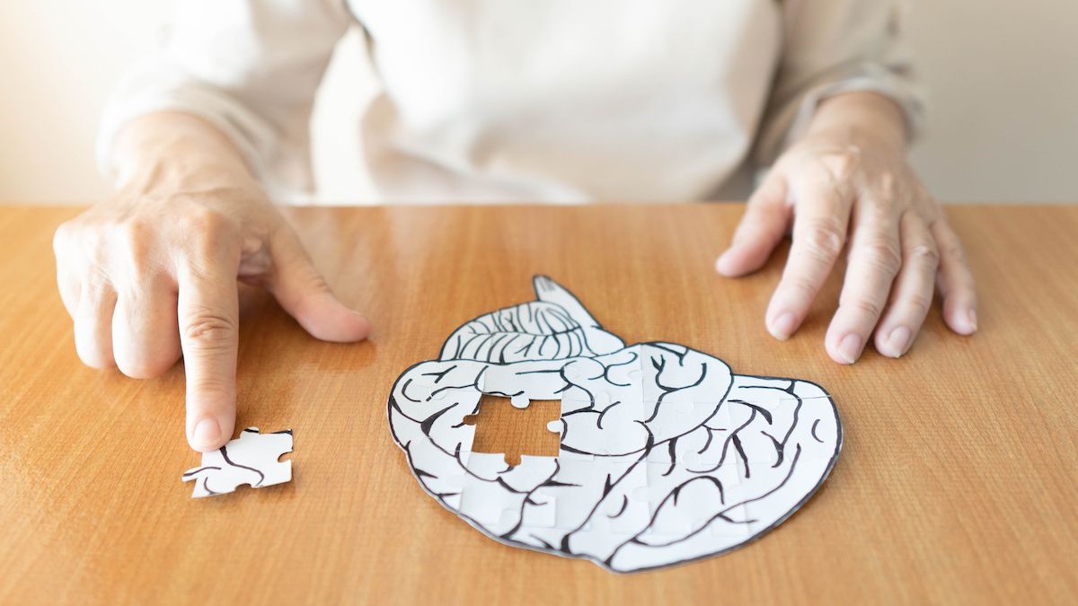 cognition and alzheimer's disease/dementia | Image credit: Orawan - stock.adobe.com