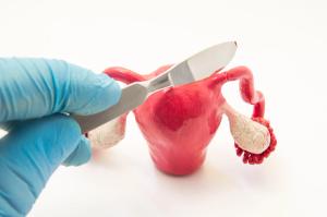 Salpingectomy demonstration | Image Credit: shidlovski - stock.adobe.com