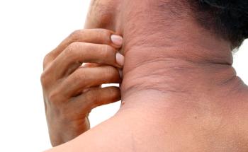 Person scratching neck.