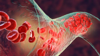 Hypertension Clot