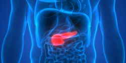 Rucaparib May Have Potential Clinical Benefit for Advanced Pancreatic Cancer