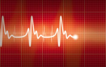 Electrocardiogram