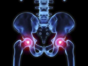 graphic of hips