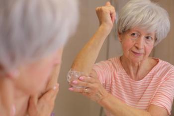 Psoriasis in older woman | Image credit: ajr_images - stock.adobe.com