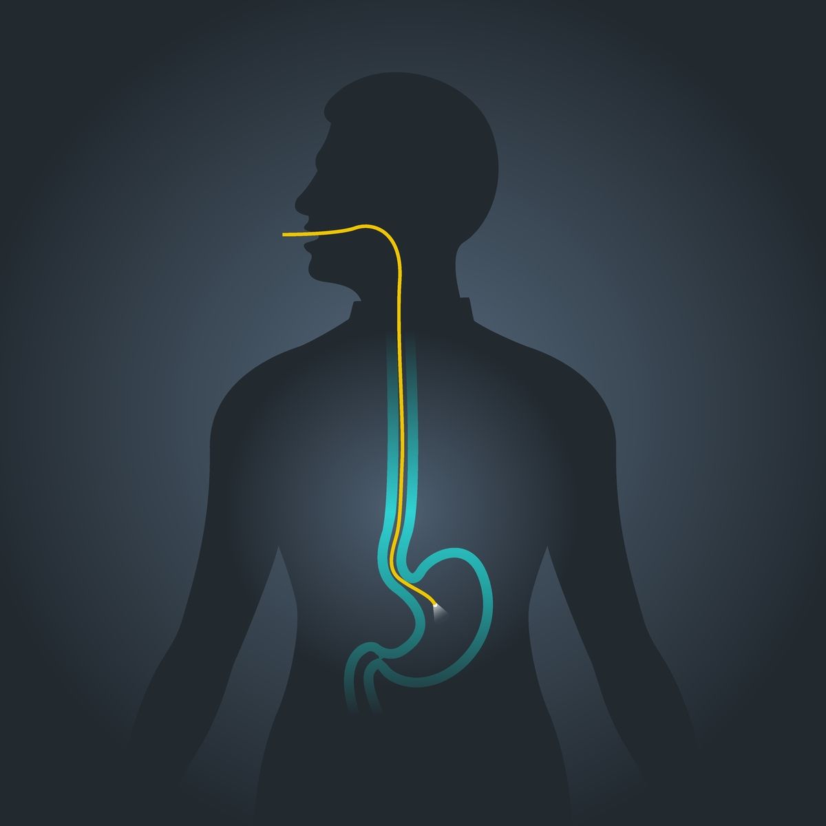 Graphic of endoscope