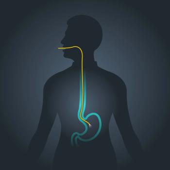 Graphic of endoscope