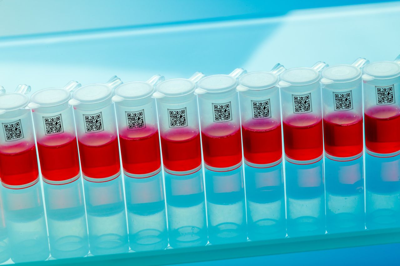 Blood samples for testing