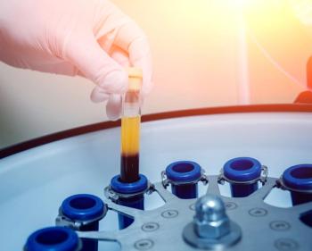 Image of genetic screening
