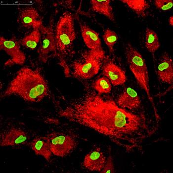 stem cells