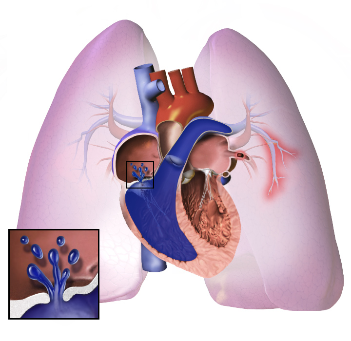 Image of heart and lungs