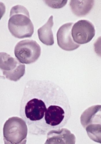 Image Credit: Armed Forces Institute of Pathology